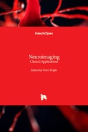 Neuroimaging