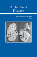 Alzheimer's Disease