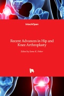 Recent Advances in Hip and Knee Arthroplasty