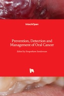 Prevention, Detection and Management of Oral Cancer