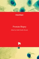 Prostate Biopsy