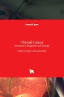 Thyroid Cancer