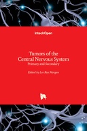 Tumors of the Central Nervous System