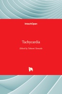 Tachycardia