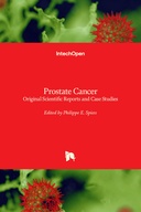 Prostate Cancer