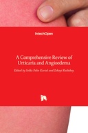 Urticaria and Angioedema