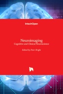 Neuroimaging