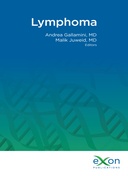 Lymphoma