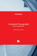 Computed Tomography