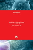 Tumor Angiogenesis