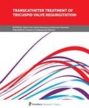 Transcatheter Treatment of Tricuspid Valve Regurgitation
