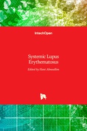 Systemic Lupus Erythematosus