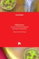 Melanoma