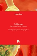 Gallstones