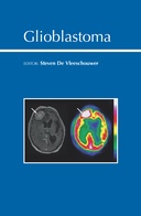 Glioblastoma