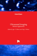 Ultrasound Imaging