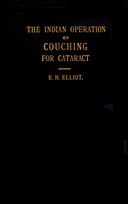 The Indian operation of couching for cataract
