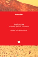 Melanoma
