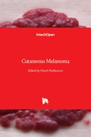 Cutaneous Melanoma