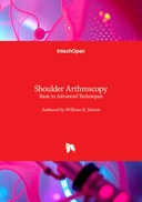 Shoulder Arthroscopy