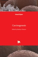 Carcinogenesis