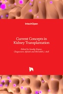 Current Concepts in Kidney Transplantation